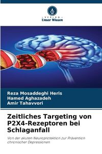Produktbild: Zeitliches Targeting von P2X4-Rezeptoren bei Schlaganfall