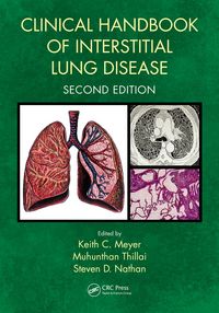 Produktbild: Clinical Handbook of Interstitial Lung Disease