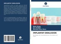 Produktbild: Implantat-Okklusion