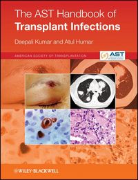 Produktbild: The AST Handbook of Transplant Infections