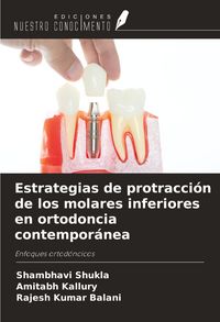 Produktbild: Estrategias de protracci&oacute;n de los molares inferiores en ortodoncia contempor&aacute;nea