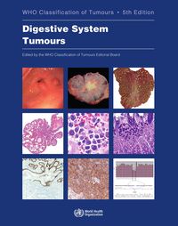 Produktbild: Digestive System Tumours