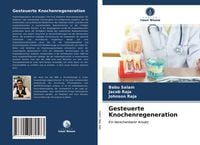 Produktbild: Gesteuerte Knochenregeneration