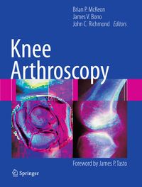 Produktbild: Knee Arthroscopy