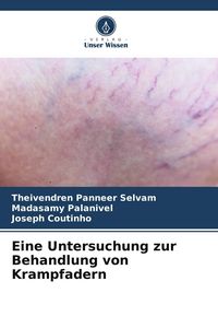 Produktbild: Eine Untersuchung zur Behandlung von Krampfadern