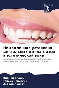 Produktbild: Nemedlennaq ustanowka dental'nyh implantatow w &auml;steticheskoj zone