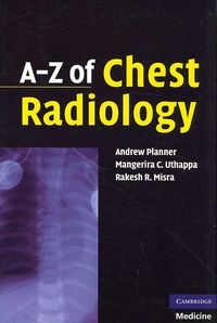 Produktbild: A-Z Of Chest Radiology