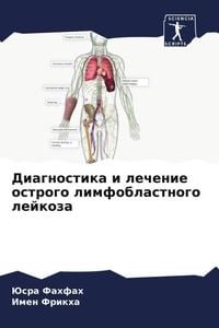 Produktbild: Diagnostika i lechenie ostrogo limfoblastnogo lejkoza