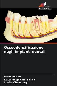 Produktbild: Osseodensificazione negli impianti dentali