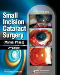 Produktbild: Small Incision Cataract Surgery (Manual Phaco)