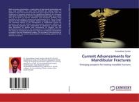 Produktbild: Current Advancements for Mandibular Fractures