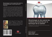 Produktbild: Morphologie du tiers apical des molaires permanentes par la technique de la clairi&egrave;re
