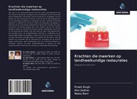 Produktbild: Krachten die inwerken op tandheelkundige restauraties