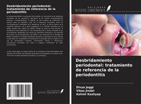 Produktbild: Desbridamiento periodontal: tratamiento de referencia de la periodontitis