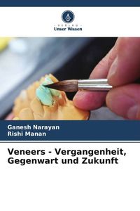 Produktbild: Veneers - Vergangenheit, Gegenwart und Zukunft
