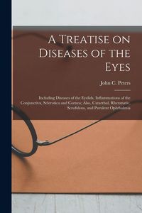 Produktbild: A Treatise on Diseases of the Eyes; Including Diseases of the Eyelids, Inflammations of the Conjunctiva, Sclerotica and Cornea; Also, Catarrhal, Rheum