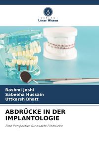 Produktbild: Abdr&uuml;cke in der Implantologie
