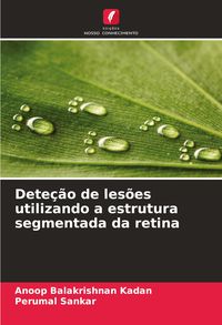 Produktbild: Dete&ccedil;&atilde;o de les&otilde;es utilizando a estrutura segmentada da retina