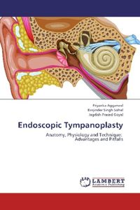 Produktbild: Aggarwal, P: Endoscopic Tympanoplasty