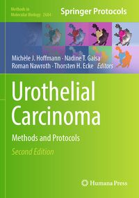 Produktbild: Urothelial Carcinoma