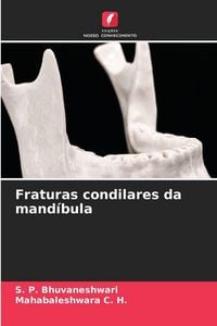 Produktbild: Fraturas condilares da mand&iacute;bula