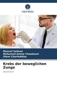 Produktbild: Krebs der beweglichen Zunge