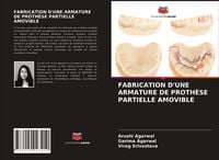 Produktbild: Fabrication D'une Armature De Proth&egrave;se Partielle Amovible