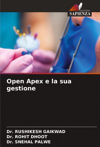 Produktbild: Open Apex e la sua gestione