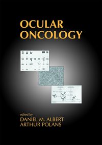 Produktbild: Ocular Oncology