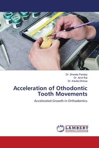 Produktbild: Acceleration of Othodontic Tooth Movements