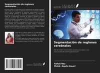 Produktbild: Segmentaci&oacute;n de regiones cerebrales