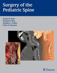 Produktbild: Surgery of the Pediatric Spine