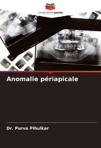 Produktbild: Anomalie p&eacute;riapicale