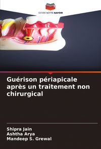 Produktbild: Gu&eacute;rison p&eacute;riapicale apr&egrave;s un traitement non chirurgical