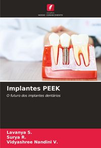 Produktbild: Implantes PEEK