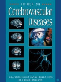 Produktbild: Primer on Cerebrovascular Diseases
