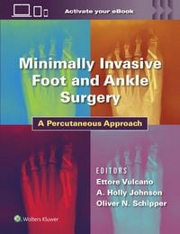 Produktbild: Minimally Invasive Foot and Ankle Surgery
