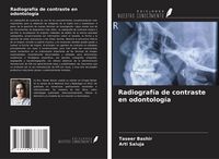 Produktbild: Radiograf&iacute;a de contraste en odontolog&iacute;a