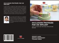 Produktbild: OCCLUSION PROT&Eacute;G&Eacute;E PAR UN IMPLANT
