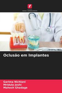 Produktbild: Oclus&atilde;o em Implantes