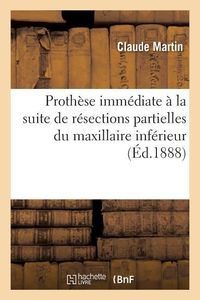 Bild vom Artikel Prothèse Immédiate À La Suite de Résections Partielles Du Maxillaire Inférieur vom Autor Claude Martin