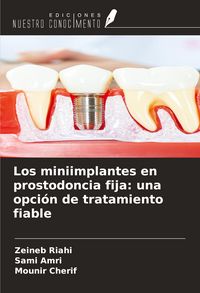 Produktbild: Los miniimplantes en prostodoncia fija: una opci&oacute;n de tratamiento fiable