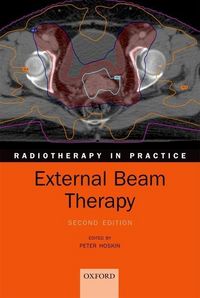 Produktbild: Hoskin, P: External Beam Therapy