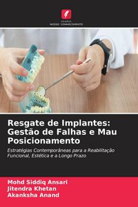 Produktbild: Resgate de Implantes: Gest&atilde;o de Falhas e Mau Posicionamento