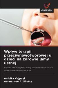 Produktbild: Wp&iquest;yw terapii przeciwnowotworowej u dzieci na zdrowie jamy ustnej