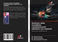 Produktbild: Gestione della mandibola completamente edentula con impianti
