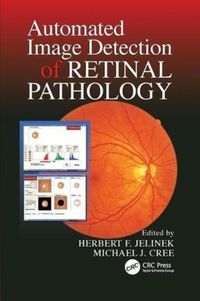 Produktbild: Jelinek, H: Automated Image Detection of Retinal Pathology