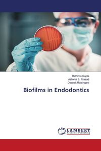 Produktbild: Biofilms in Endodontics