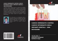 Produktbild: Carico Immediato Contro Carico Ritardato Degli Impianti Dentali - Una Revisione