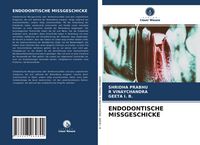 Produktbild: Endodontische Missgeschicke